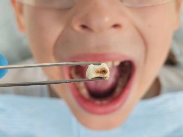 Best Pediatric Emergency Dentist in Emeryville, CA